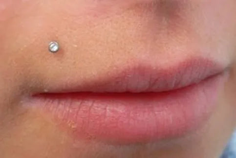 Oral Piercing Procedure