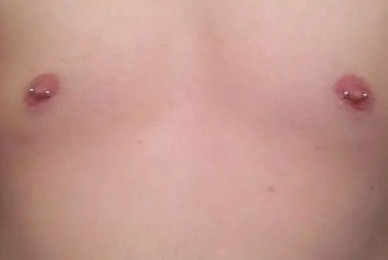 Torso Piercing Procedures