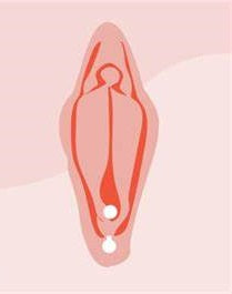Female Genital Piercing Procedures